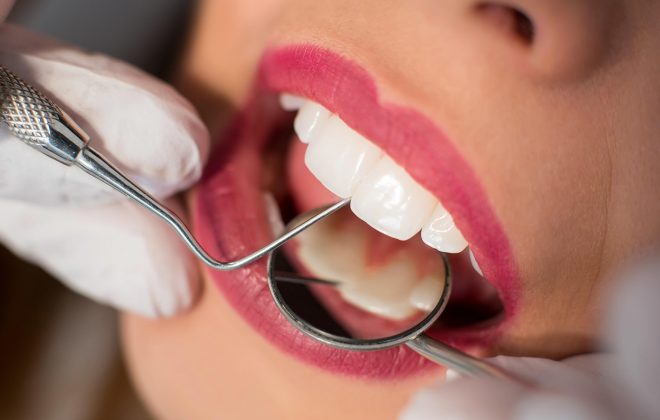 أنواع كراون الاسنان