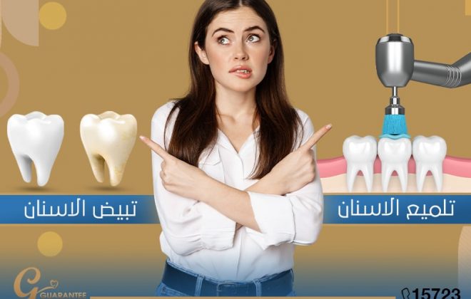 الفرق بين تبييض وتلميع الاسنان