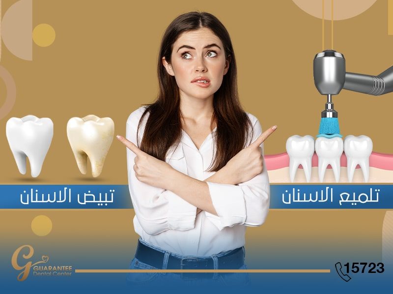 الفرق بين تبييض وتلميع الاسنان