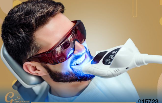 درجات تبييض الاسنان