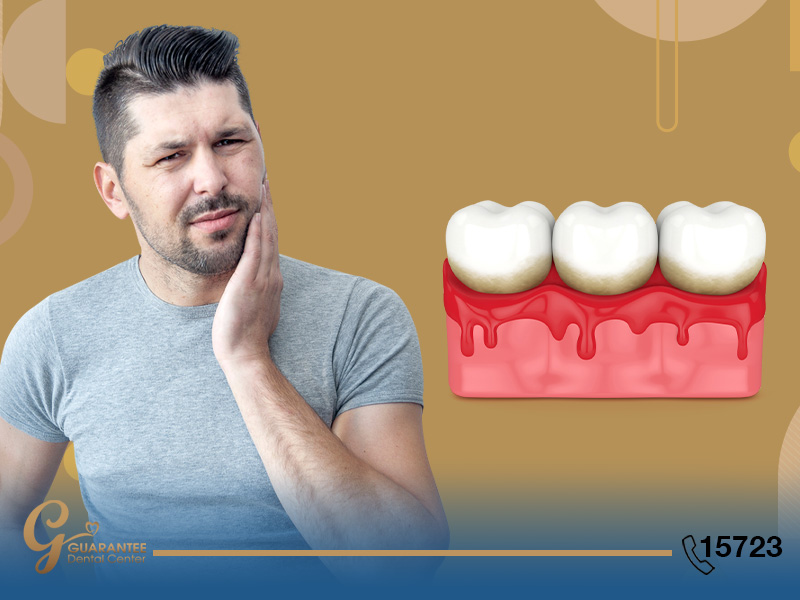هل التهاب اللثة يسبب ألم الأسنان